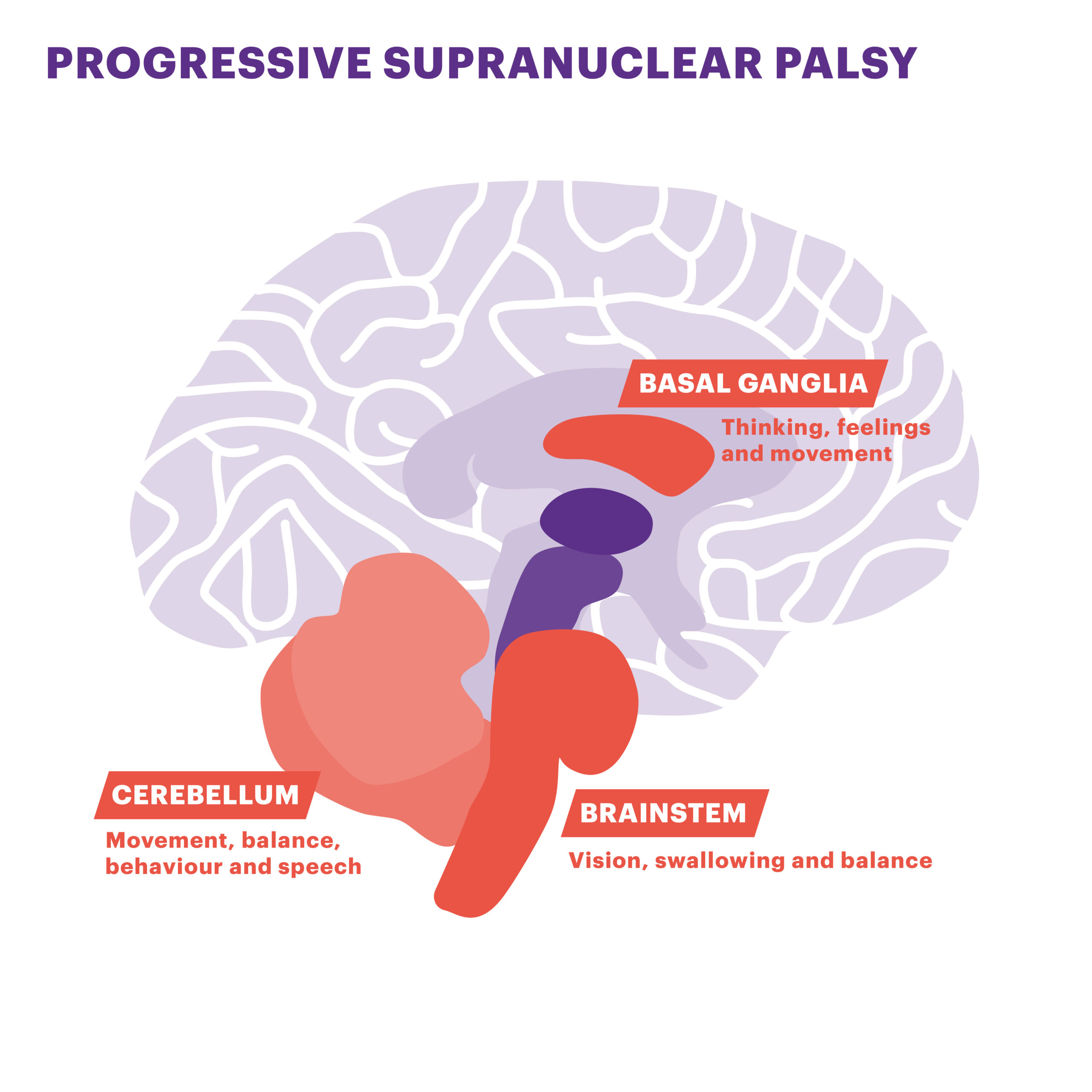 brain diagram_PSP